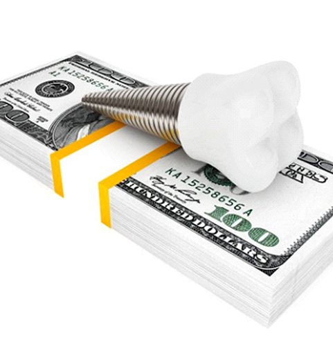 dental implant lying on top of a stack of cash