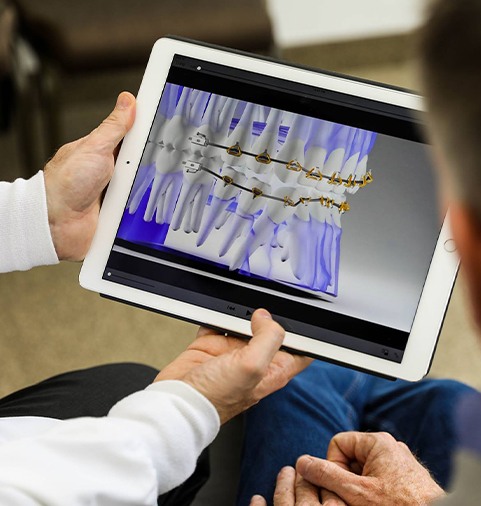 Dentist showing patient SureSmile system on computer